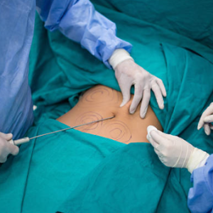 Basic Liposculpting Course